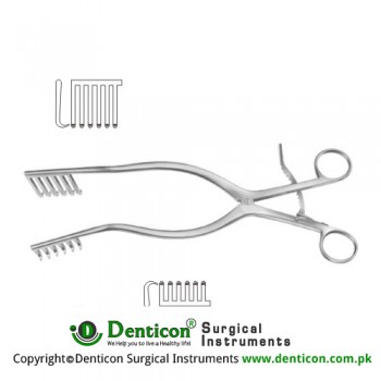 Martin Self Retaining Retractor 6 x 6 Sharp Long Prongs Teeth on Right Side Stainless Steel, 28.5 cm - 11 1/4"